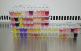 Testy cech biochemicznych bakterii występujących w wodzie